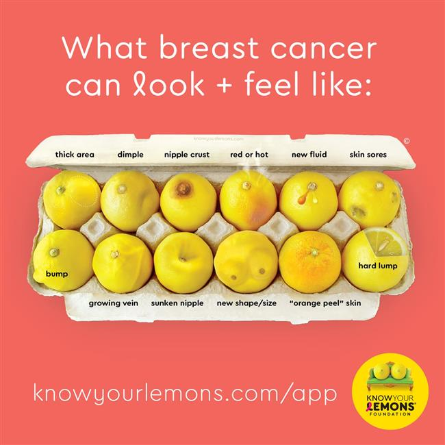 Know your lemons image, What breast cancer can look and feel like